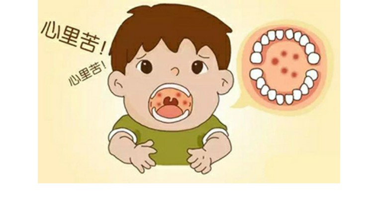 疱疹性咽峡炎高发，这些知识要了解！