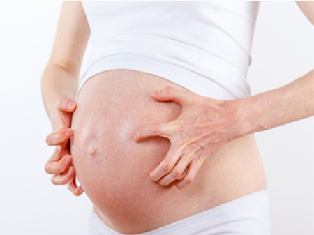 准妈妈皮肤瘙痒，可适当用药！