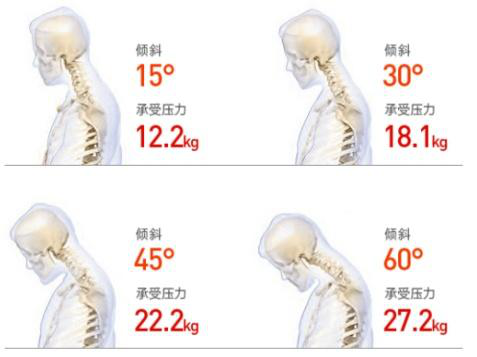 颈椎僵硬怎么办？三步告别颈椎烦恼